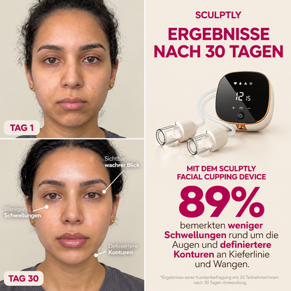 Sculptly - Elektrisches Facial Cupping Gerät