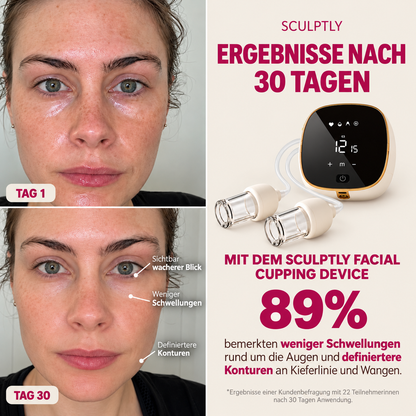 Sculptly - Elektrisches Facial Cupping Gerät