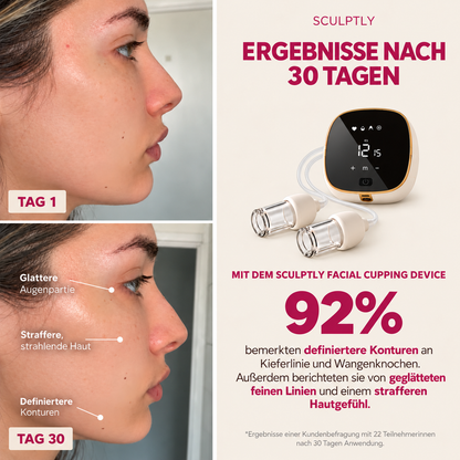 Sculptly - Elektrisches Facial Cupping Gerät